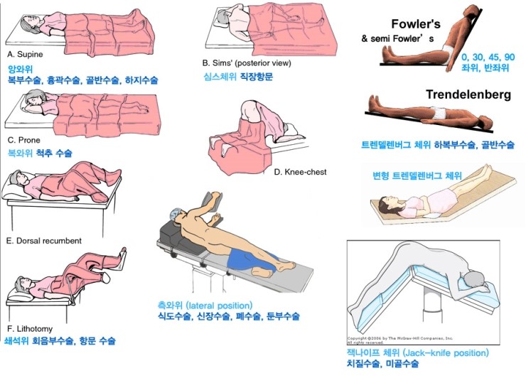 [기본간호] 체위[Supine(앙와위), Prone(복위, 복와위), Sims'(posterior, 심스체위), Kneechest, Dorsal recumbent(배횡와위