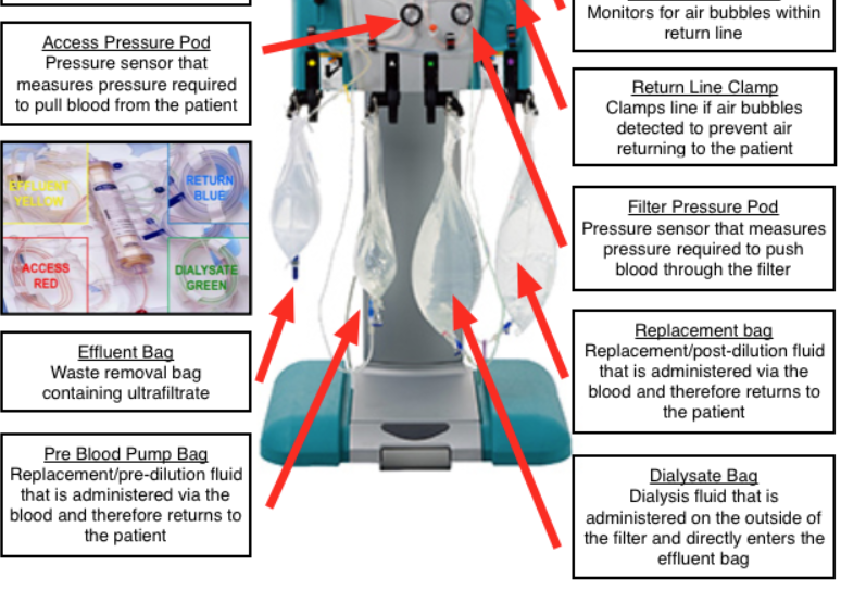 쉽게 이해하는 CRRT(Continuous Renal Replacement Therapy) 네이버 블로그